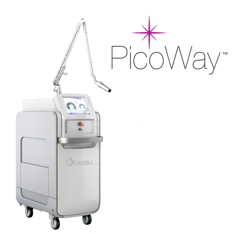 Picoway Laser: Tattoo and Pigment Lesions Removal Made Easy